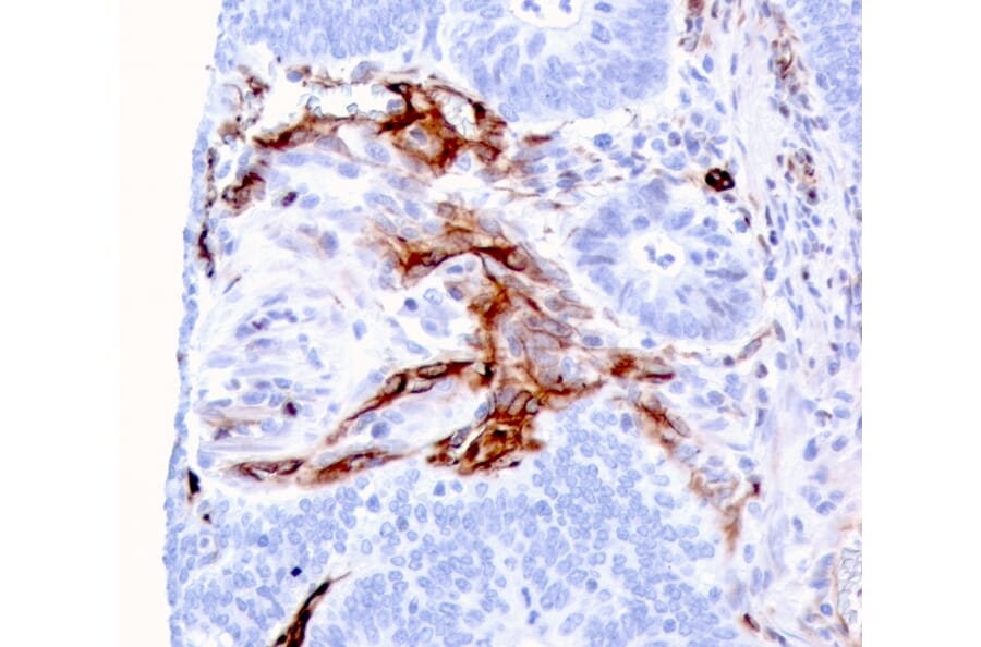 Immunohistochemistry - Anti-Nestin Antibody [NES/2911] (A248152) - Antibodies.com