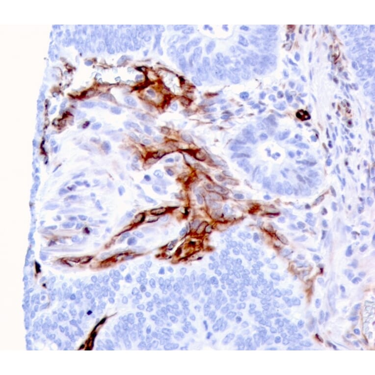 Immunohistochemistry - Anti-Nestin Antibody [NES/2911] (A248152) - Antibodies.com