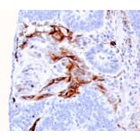 Immunohistochemistry - Anti-Nestin Antibody [NES/2911] (A248152) - Antibodies.com