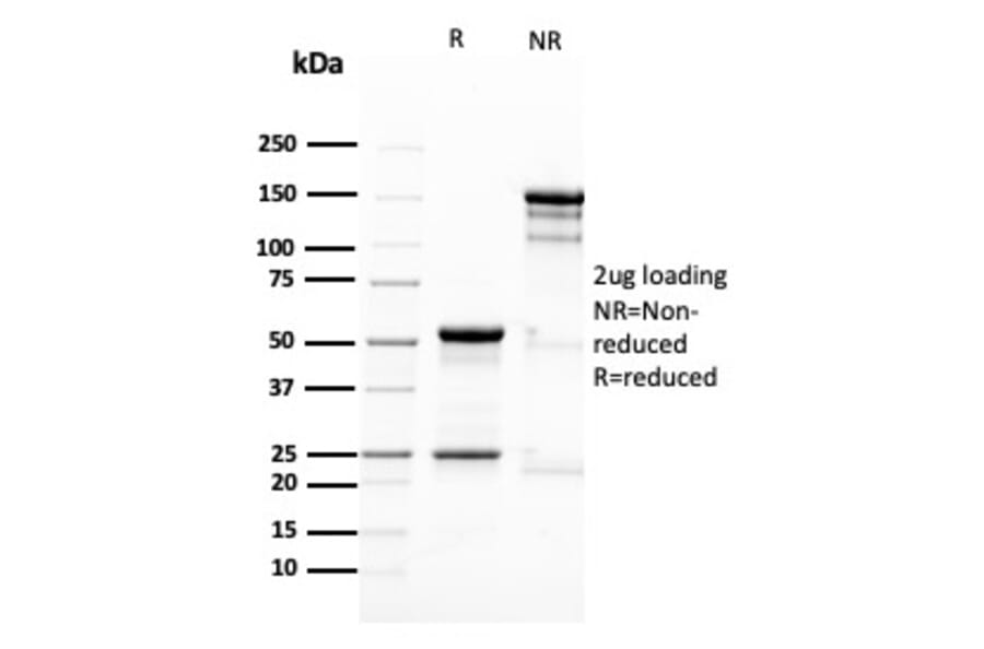 SDS-PAGE - Anti-Nestin Antibody [NES/2911] (A248153) - Antibodies.com