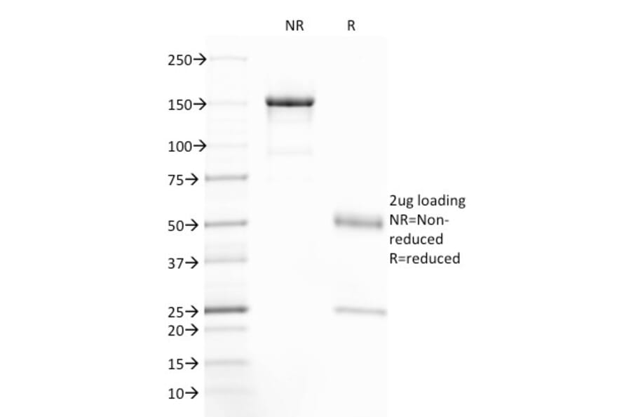 SDS-PAGE - Anti-CFTR Antibody [CFTR/1785] (A248154) - Antibodies.com