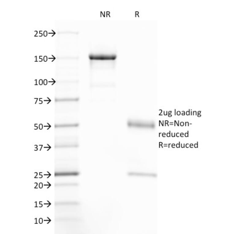 SDS-PAGE - Anti-CFTR Antibody [CFTR/1785] (A248154) - Antibodies.com