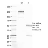 SDS-PAGE - Anti-CFTR Antibody [CFTR/1785] (A248154) - Antibodies.com