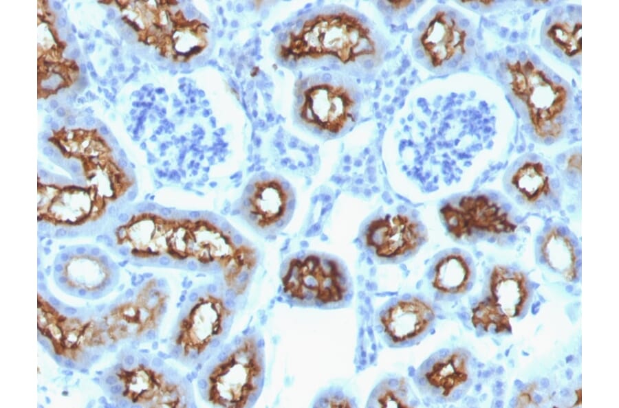 Immunohistochemistry - Anti-CFTR Antibody [CFTR/1342] (A248156) - Antibodies.com
