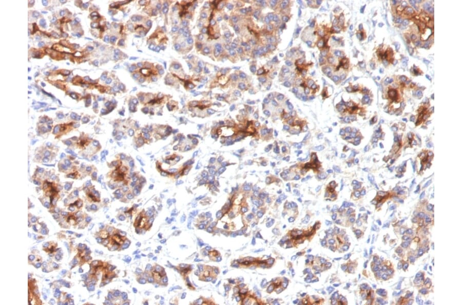 Immunohistochemistry - Anti-CFTR Antibody [SPM176] (A248156) - Antibodies.com