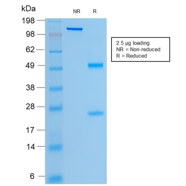 SDS-PAGE - Anti-CFTR Antibody [rCFTR/1342] (A248160) - Antibodies.com