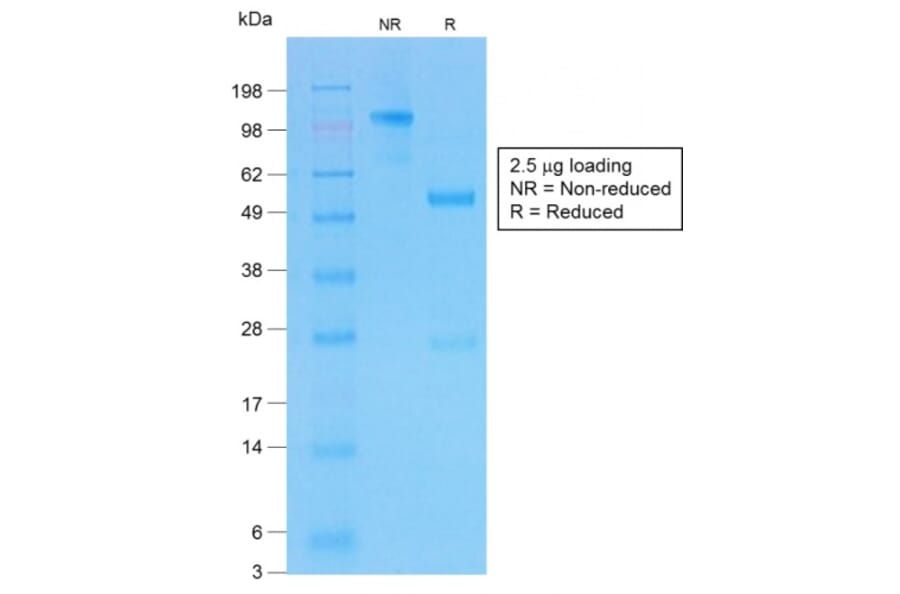 SDS-PAGE - Anti-CFTR Antibody [CFTR/1775R] (A248161) - Antibodies.com