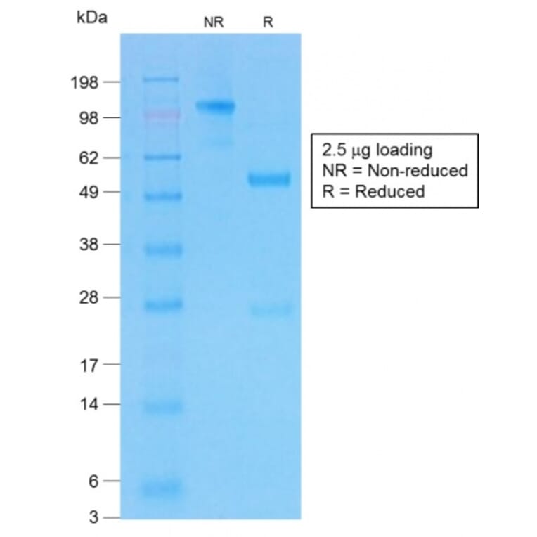 SDS-PAGE - Anti-CFTR Antibody [CFTR/1775R] (A248161) - Antibodies.com