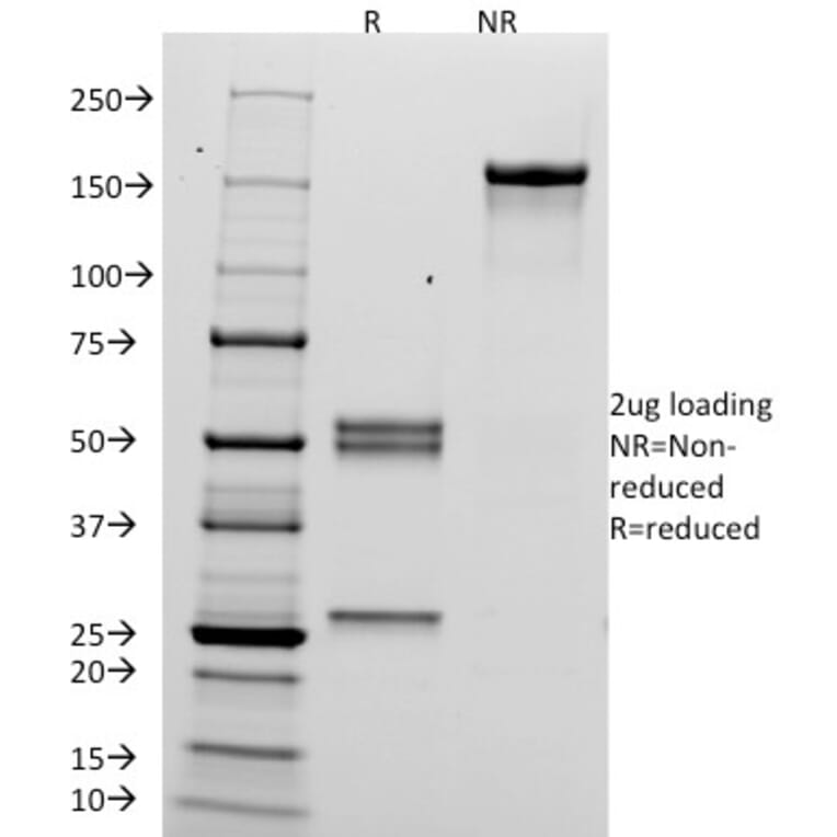 SDS-PAGE - Anti-HCG alpha Antibody [HCGa/53] (A248164) - Antibodies.com