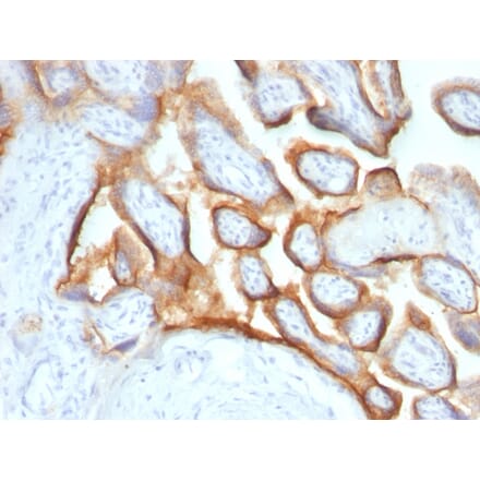 Immunohistochemistry - Anti-HCG alpha Antibody [SPM552] (A248164) - Antibodies.com