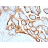 Immunohistochemistry - Anti-HCG alpha Antibody [SPM552] (A248164) - Antibodies.com