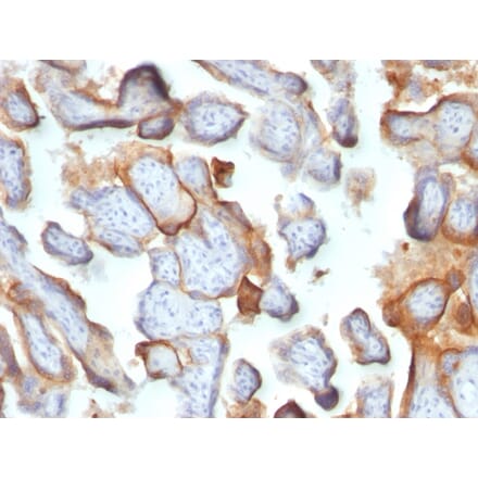 Immunohistochemistry - Anti-HCG beta Antibody [SPM105] (A248167) - Antibodies.com