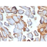 Immunohistochemistry - Anti-HCG beta Antibody [SPM105] (A248167) - Antibodies.com