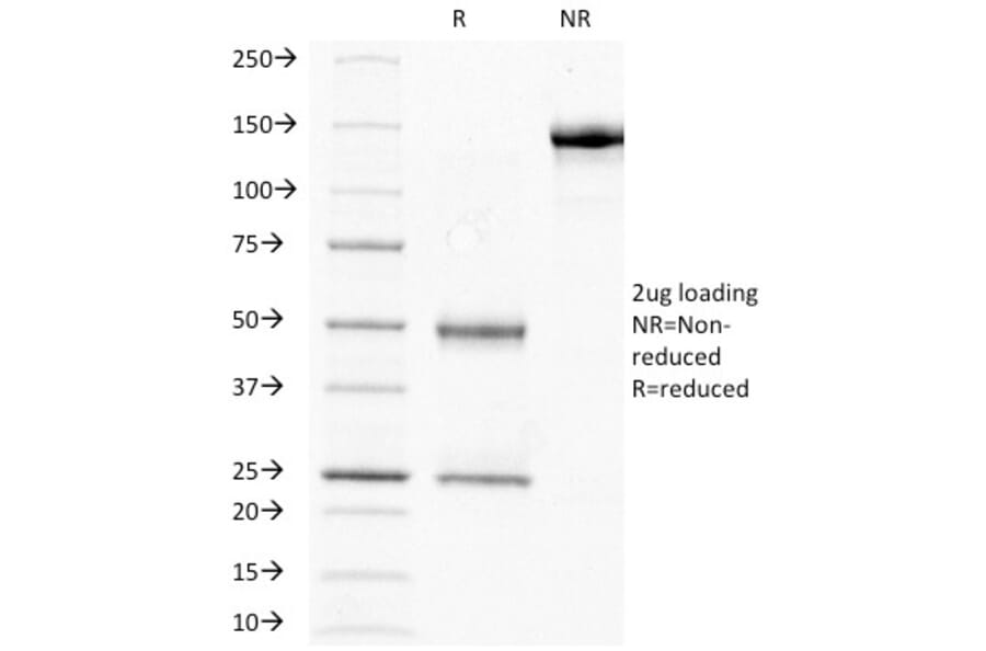 SDS-PAGE - Anti-HCG beta Antibody [HCGb/211] (A248170) - Antibodies.com