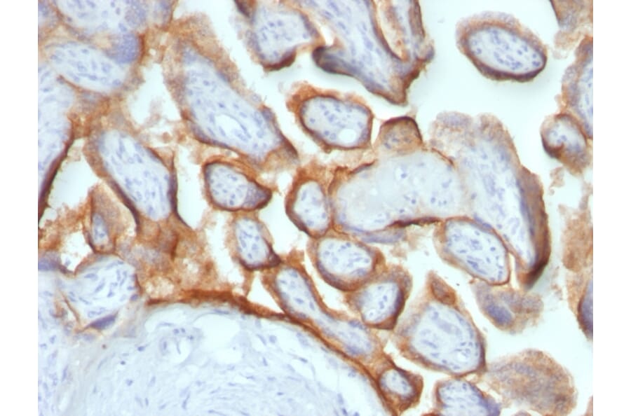 Immunohistochemistry - Anti-HCG beta Antibody [HCGb/54+ HCGb/459] (A248171) - Antibodies.com