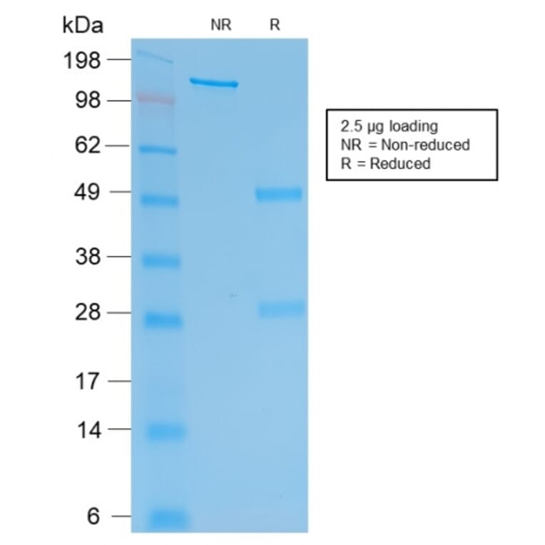 SDS-PAGE - Anti-HCG beta Antibody [rHCGb/54] (A248173) - Antibodies.com