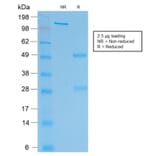 SDS-PAGE - Anti-HCG beta Antibody [rHCGb/54] (A248173) - Antibodies.com