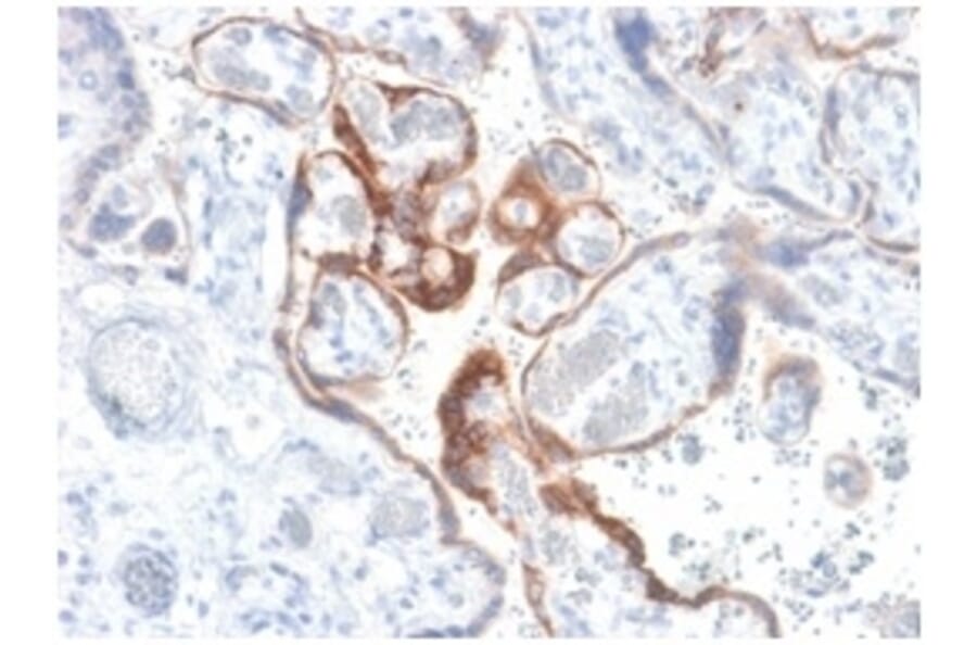 Immunohistochemistry - Anti-HCG beta Antibody [HCGb/1985R] (A248173) - Antibodies.com