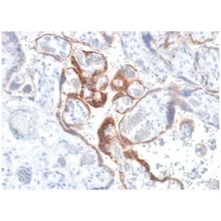 Immunohistochemistry - Anti-HCG beta Antibody [HCGb/1985R] (A248173) - Antibodies.com