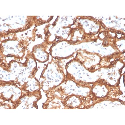 Immunohistochemistry - Anti-HCG beta Antibody [HCGb/2728R] (A248176) - Antibodies.com