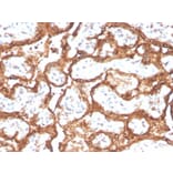 Immunohistochemistry - Anti-HCG beta Antibody [HCGb/2728R] (A248176) - Antibodies.com