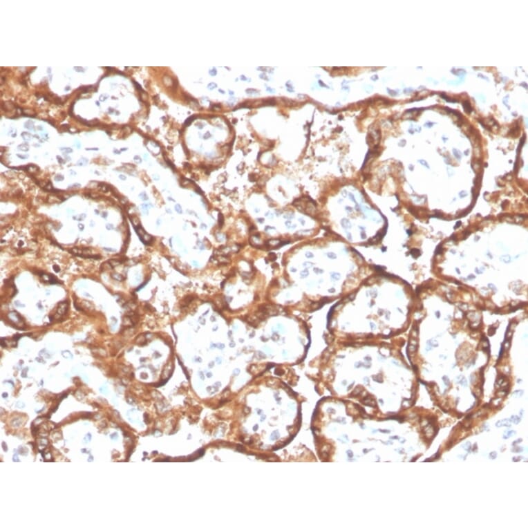 Immunohistochemistry - Anti-HCG beta Antibody [HCGb/2728R] (A248175) - Antibodies.com