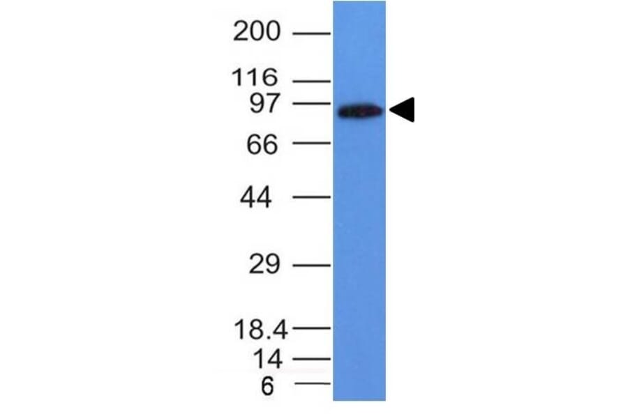 Western Blot - Anti-MALT1 Antibody [MT1/410] (A248178) - Antibodies.com
