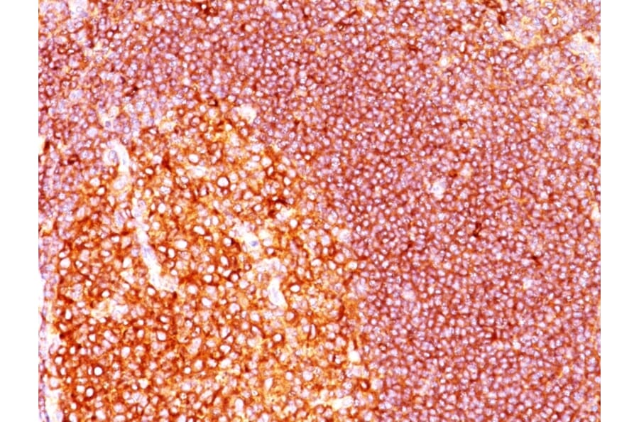 Immunohistochemistry - Anti-MALT1 Antibody [MT1/410] (A248176) - Antibodies.com
