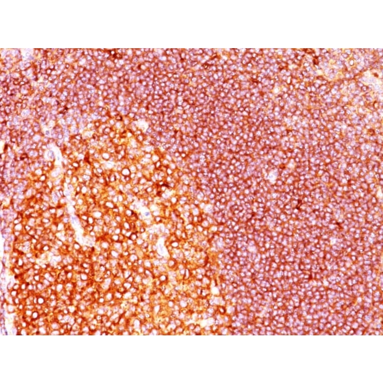Immunohistochemistry - Anti-MALT1 Antibody [MT1/410] (A248176) - Antibodies.com