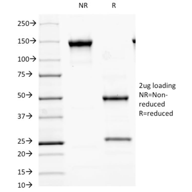 SDS-PAGE - Anti-MALT1 Antibody [MT1/410] (A248178) - Antibodies.com