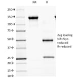 SDS-PAGE - Anti-MALT1 Antibody [MT1/410] (A248178) - Antibodies.com