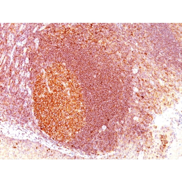 Immunohistochemistry - Anti-MALT1 Antibody [SPM578] (A248178) - Antibodies.com