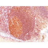 Immunohistochemistry - Anti-MALT1 Antibody [SPM578] (A248178) - Antibodies.com