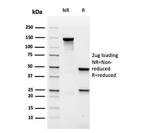 SDS-PAGE - Anti-MALT1 Antibody [rMT1/410] (A248180) - Antibodies.com