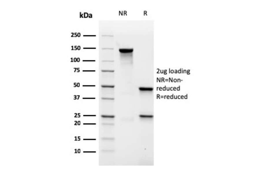 SDS-PAGE - Anti-MALT1 Antibody [rMT1/410] (A248180) - Antibodies.com