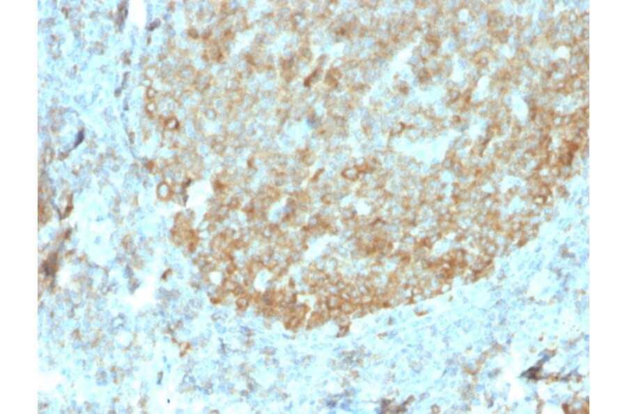 Immunohistochemistry - Anti-MALT1 Antibody [rMT1/410] (A248179) - Antibodies.com