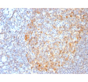 Immunohistochemistry - Anti-MALT1 Antibody [MT1/3159R] (A248180) - Antibodies.com