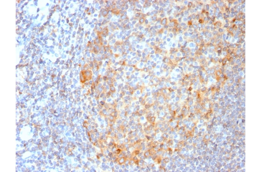 Immunohistochemistry - Anti-MALT1 Antibody [MT1/3159R] (A248180) - Antibodies.com