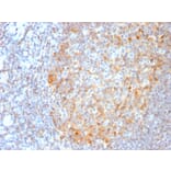 Immunohistochemistry - Anti-MALT1 Antibody [MT1/3159R] (A248180) - Antibodies.com