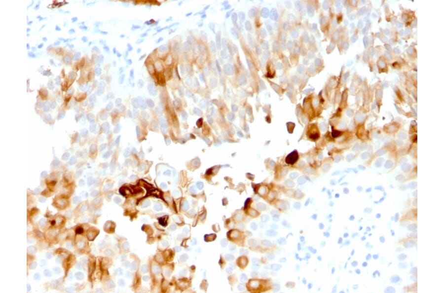 Immunohistochemistry - Anti-Uroplakin 1A Antibody [UPK1A/2921] (A248182) - Antibodies.com