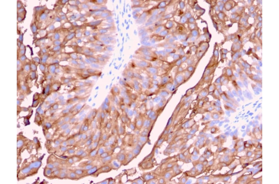 Immunohistochemistry - Anti-Uroplakin 1A Antibody [UPK1A/2921] (A248182) - Antibodies.com