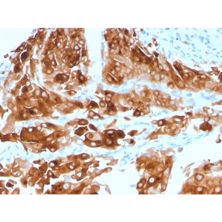 Immunohistochemistry - Anti-Uroplakin 1A Antibody [UPK1A/2921] (A248182) - Antibodies.com
