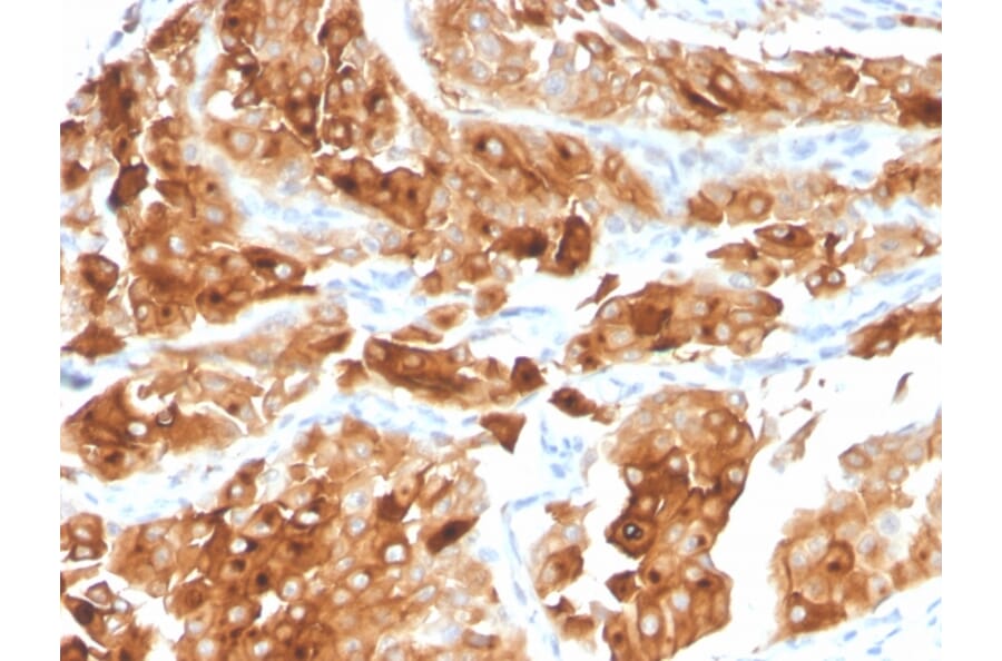 Immunohistochemistry - Anti-Uroplakin 1A Antibody [UPK1A/2922] (A248183) - Antibodies.com