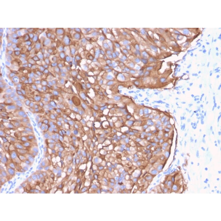 Immunohistochemistry - Anti-Uroplakin 1A Antibody [UPK1A/2922] (A248183) - Antibodies.com