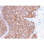 Immunohistochemistry - Anti-Uroplakin 1A Antibody [UPK1A/2922] (A248183) - Antibodies.com
