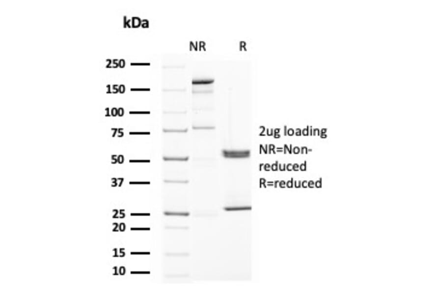 SDS-PAGE - Anti-Uroplakin 1A Antibody [UPK1A/2922] (A248183) - Antibodies.com