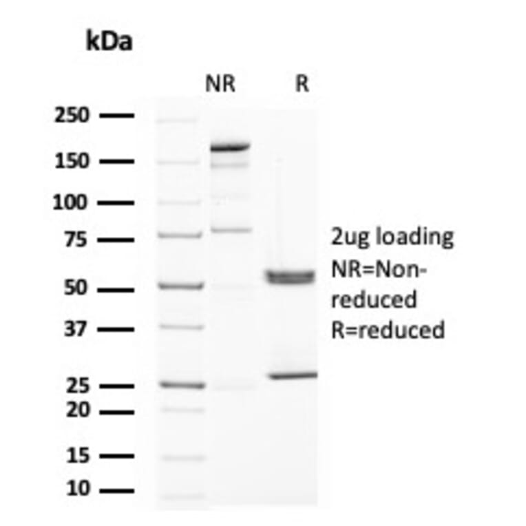 SDS-PAGE - Anti-Uroplakin 1A Antibody [UPK1A/2922] (A248183) - Antibodies.com