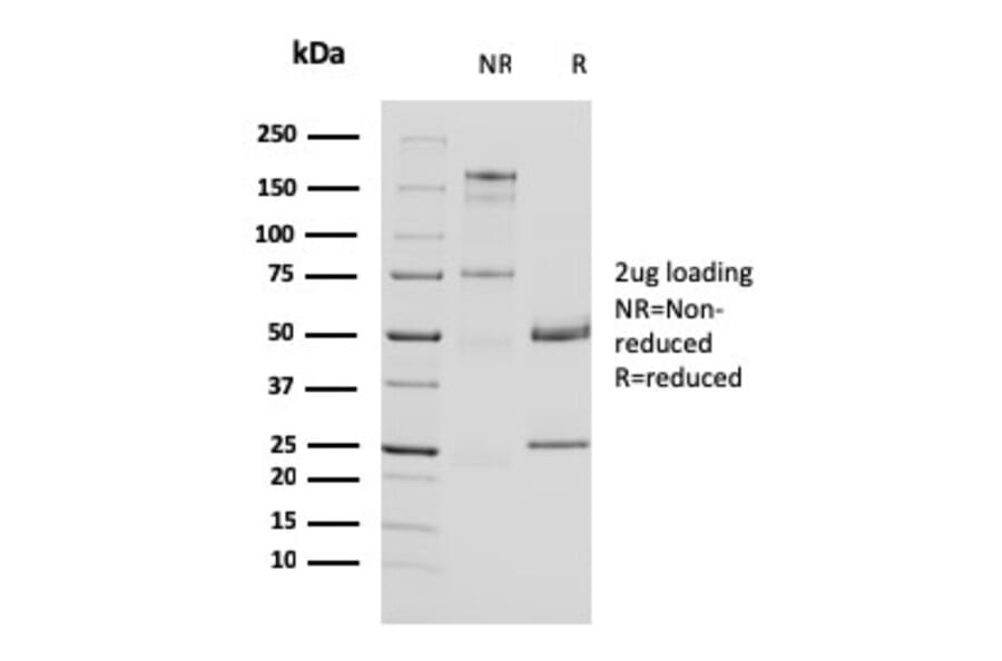 SDS-PAGE - Anti-Uroplakin 1A Antibody [UPK1A/2924] (A248185) - Antibodies.com