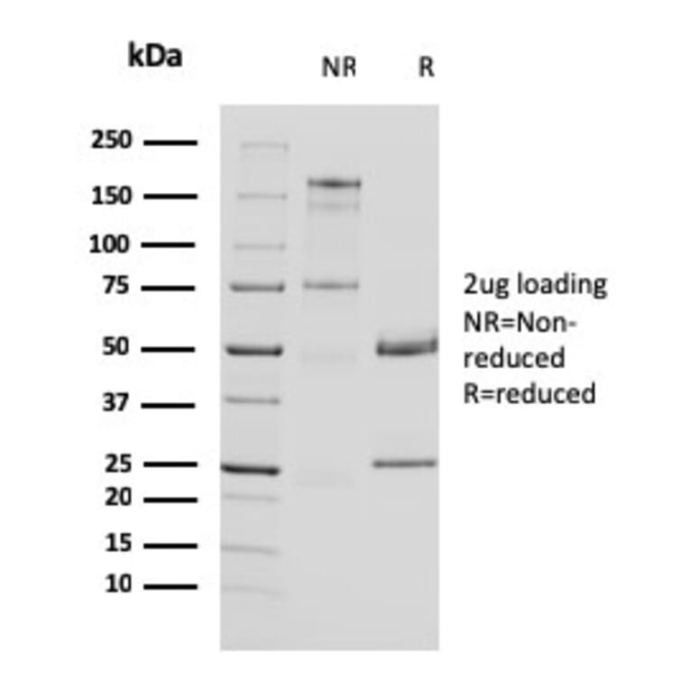SDS-PAGE - Anti-Uroplakin 1A Antibody [UPK1A/2924] (A248185) - Antibodies.com