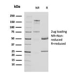 SDS-PAGE - Anti-Uroplakin 1A Antibody [UPK1A/2924] (A248185) - Antibodies.com